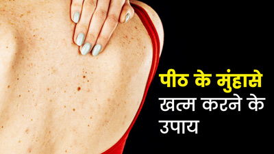 टी ट्री ऑयल और नारियल का तेल करेगा पीठ के मुंहासों को खत्म, जानें इस्तेमाल का तरीका